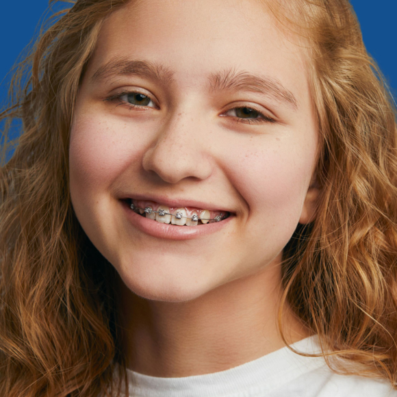 image of smiling young orthodontic patient with metal braces