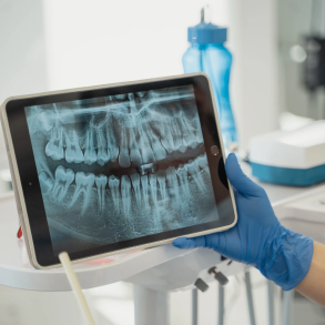 Teeth Image - X-Ray